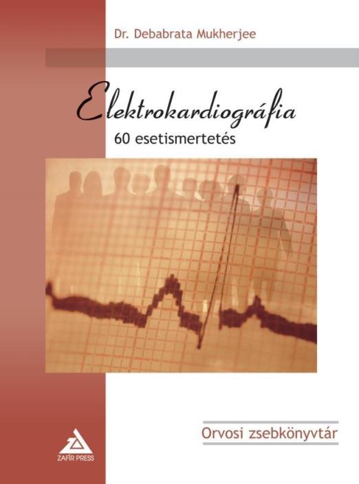ELEKTROKARDIOGRÁFIA - 60 ESETISMERTETÉS