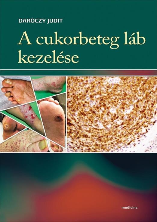 A CUKORBETEG LÁB KEZELÉSE