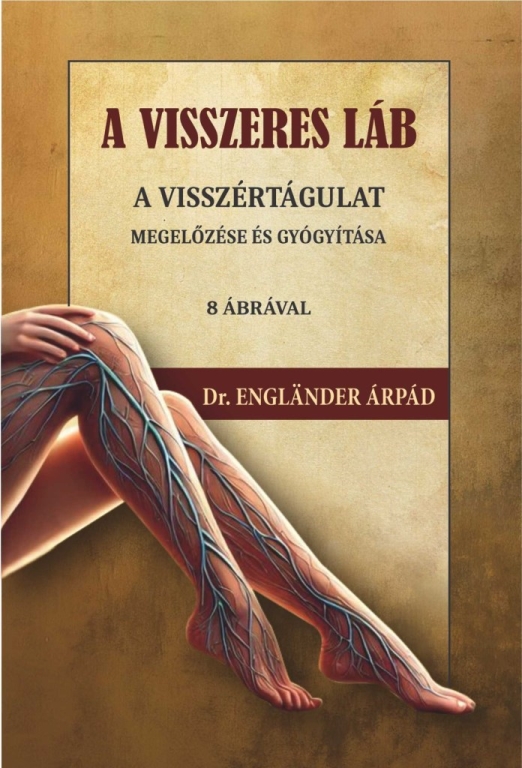 A VISSZERES LÁB -  A VISSZÉRTÁGULAT MEGELŐZÉSE ÉS GYÓGYÍTÁSA